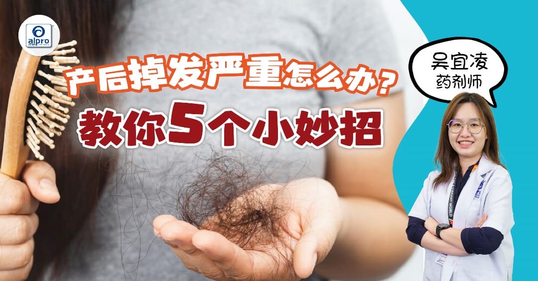 Featured image for 产后掉发严重怎么办?教你5个小妙招