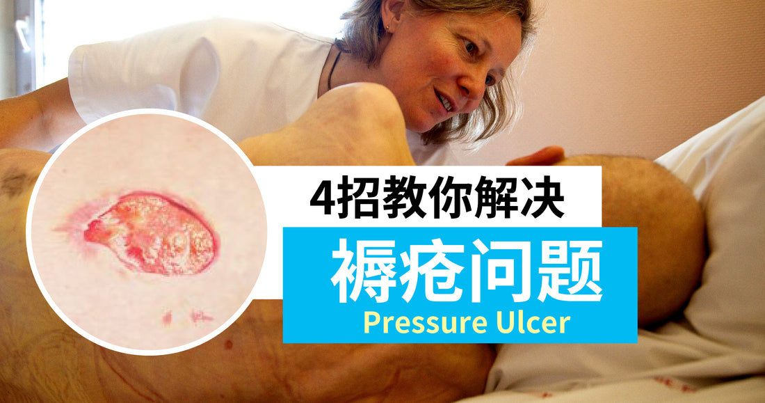 Featured image for 【健康资讯】什么是褥疮 Pressure Ulcer？4招教你解决它！