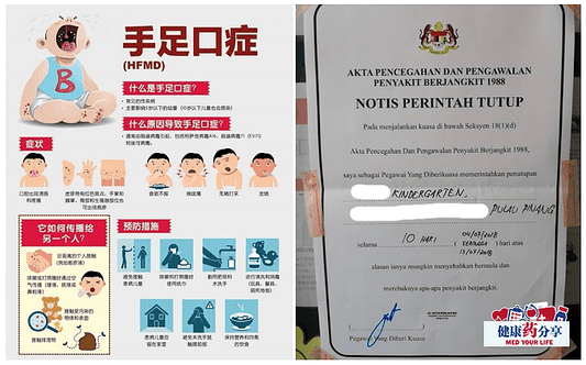 Featured image for 到底如何预防手足口症？听听专业医生怎么说？