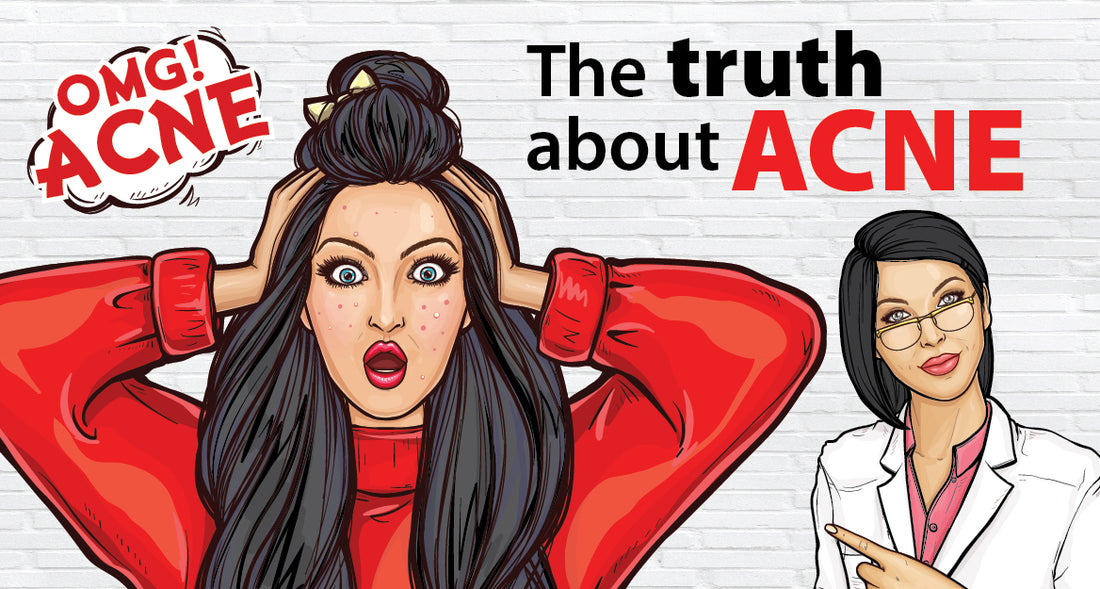 Featured image for The Truth About Acne