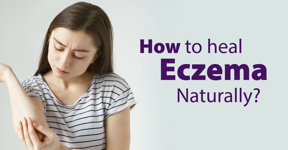 Featured image for How to Heal Eczema Naturally?