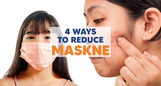Featured image for 4 Ways to Reduce Maskne