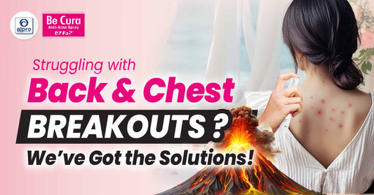 Featured image for No More Breakouts - Just Spray & Slay Be Cura