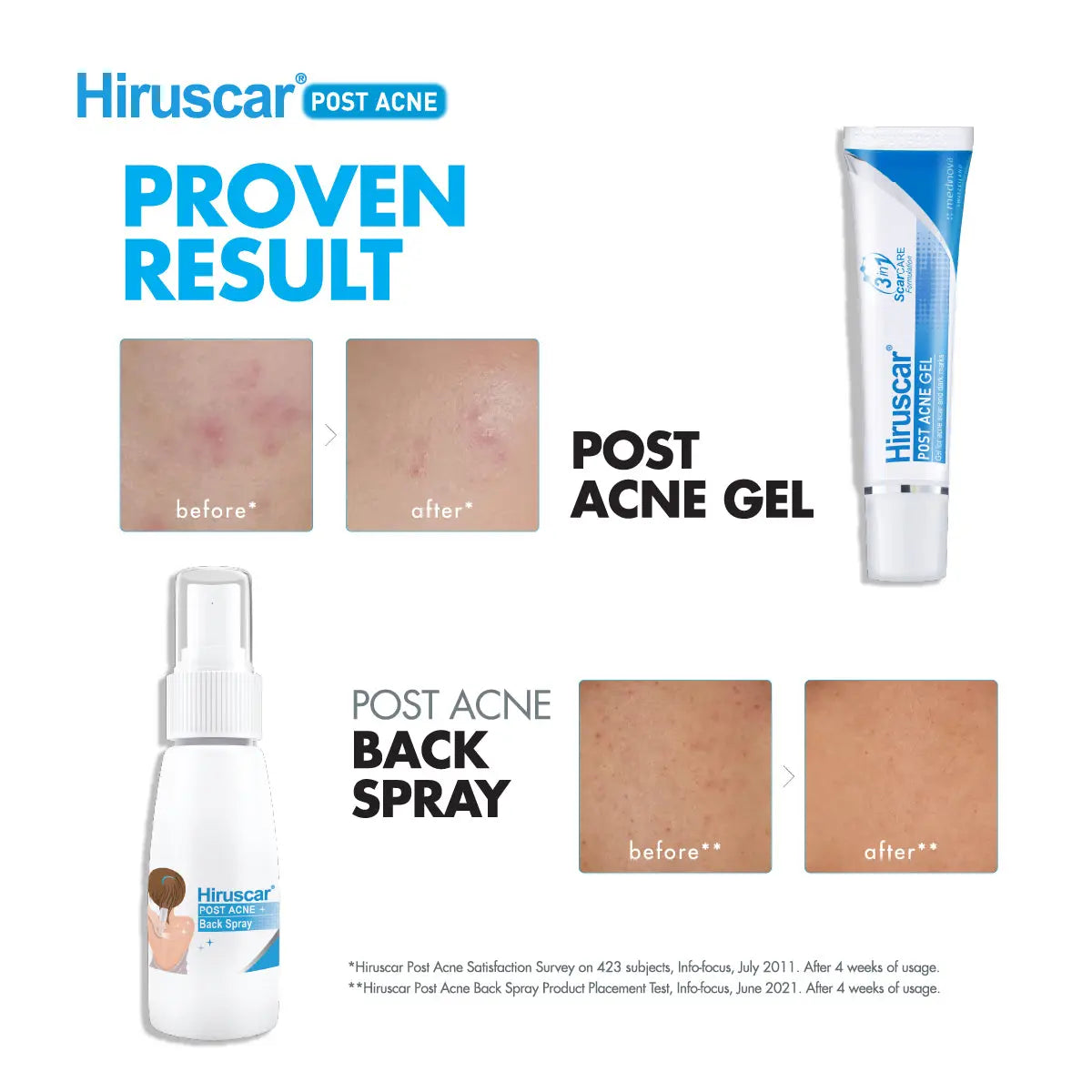 Hiruscar 3 In1 Post Acne 10g | Improve and Smoothen Acne Scars Hiruscar