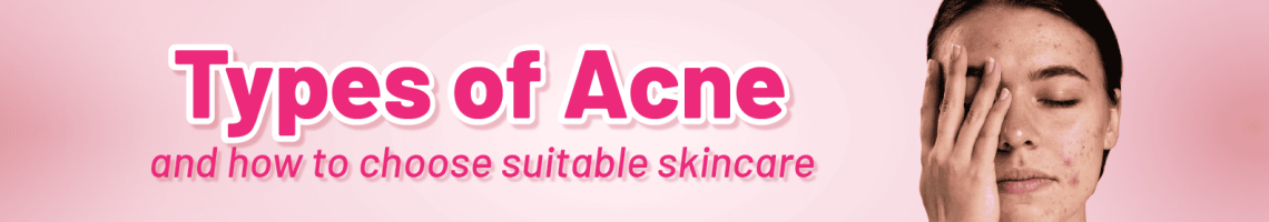 types of acne - mid banner